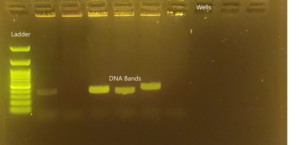 Gel Electrophoresis