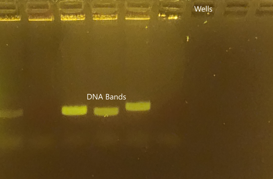 Gel Electrophoresis