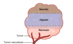Oxygen and Cancer: Within the Tumor