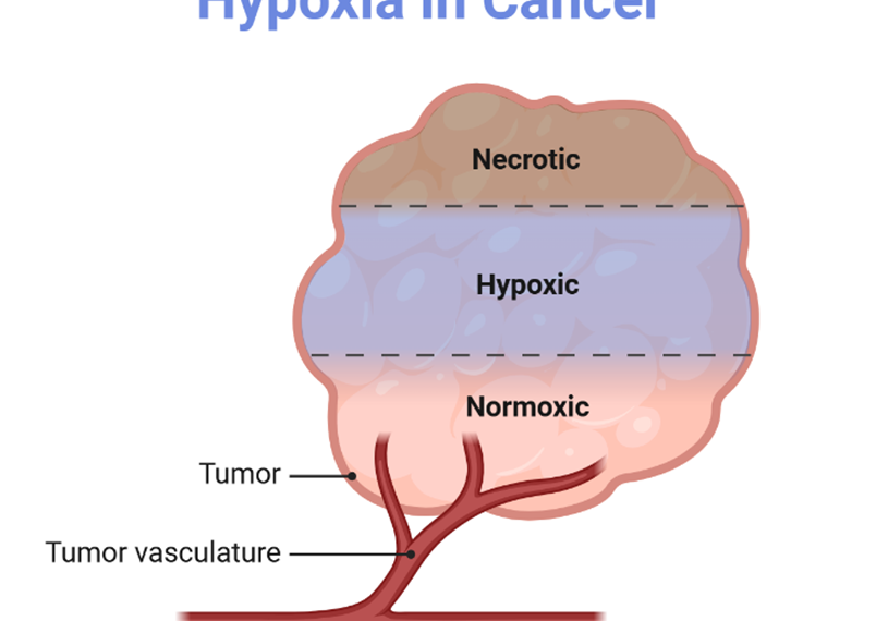 Oxygen and Cancer: Within the Tumor